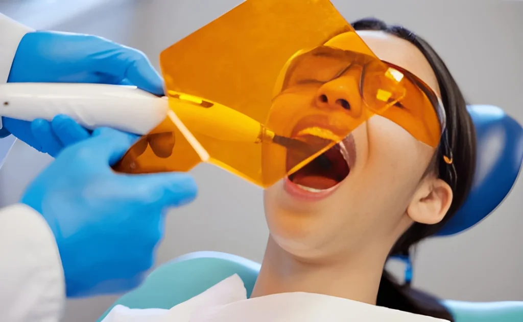 dental fillings in sherwood park