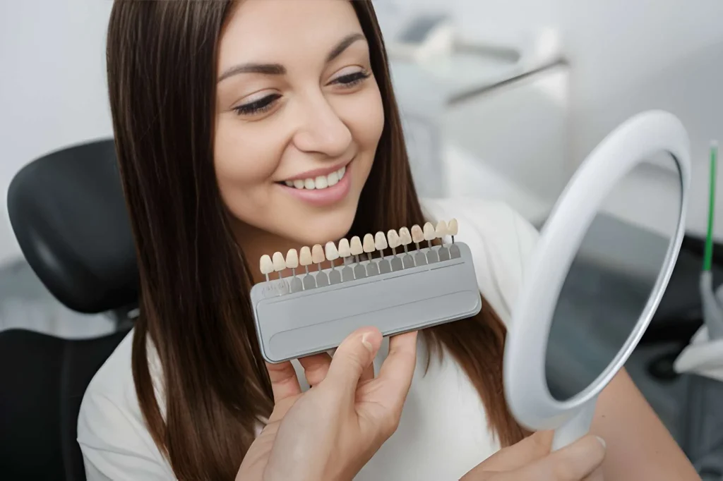dental venners near you